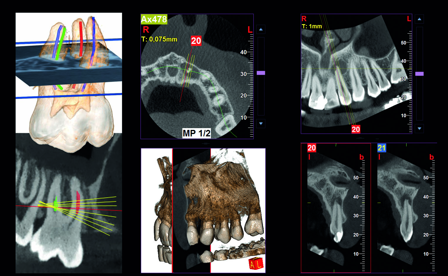 ENDODONTİK TETKİK 