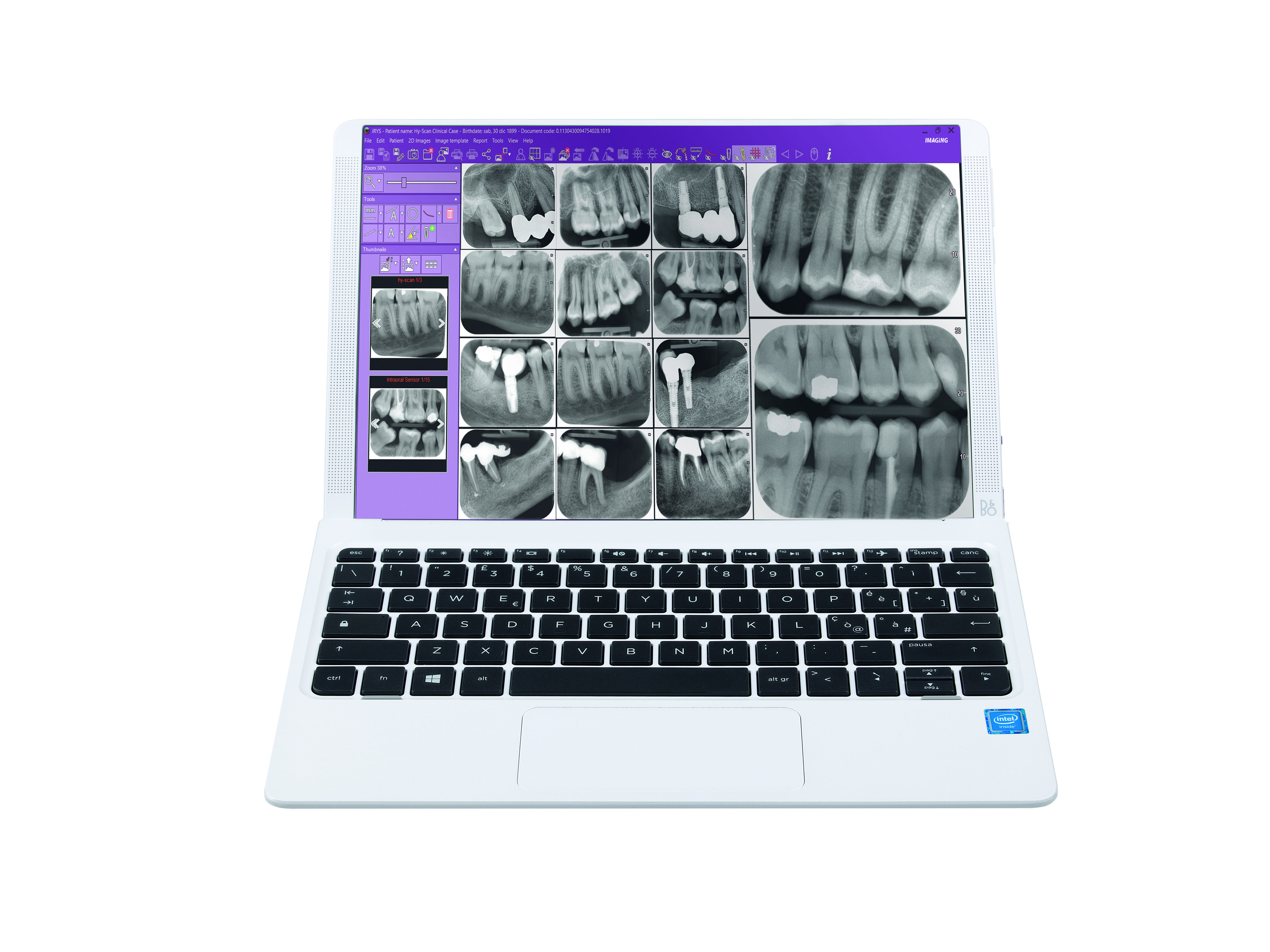iRYS - iPad BAĞLANTISI