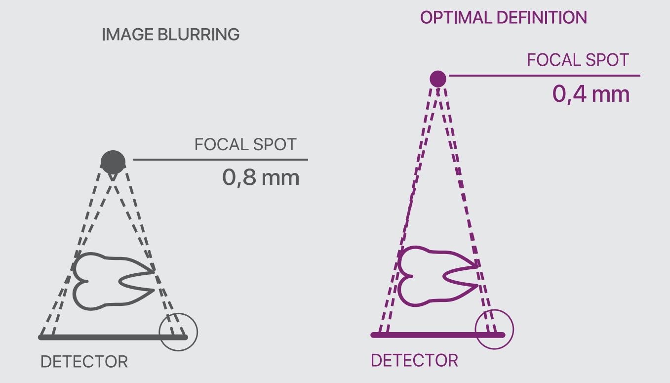 YÜKSEK ÇÖZÜNÜRLÜKLÜ TEŞHİS